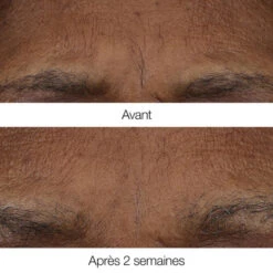 Clinique - Smart Clinical Repair Baume Rétinoïde Anti-rides 7 Clinique - Smart Clinical Repair Baume Rétinoïde Anti-rides -Parfumerie Burdin Boutique clinique smart clinical repair baume retinoide anti rides 2