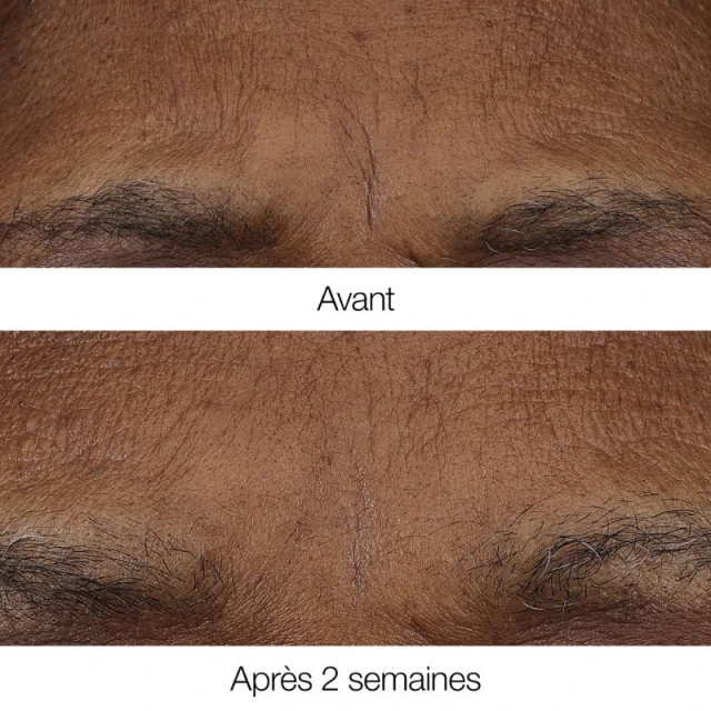 Clinique - Smart Clinical Repair Baume Rétinoïde Anti-rides 3 Clinique - Smart Clinical Repair Baume Rétinoïde Anti-rides – Image 3