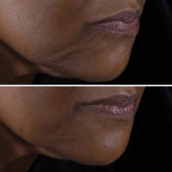 Clinique - Smart Clinical Repair Crème Liftante Visage Et Cou -Parfumerie Burdin Boutique clinique smart clinical repair creme liftante 3