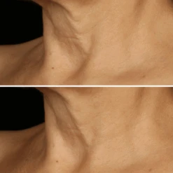 Clinique - Smart Clinical Repair Crème Liftante Visage Et Cou -Parfumerie Burdin Boutique clinique smart clinical repair creme liftante 5