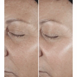 Clinique - Smart Clinical Repair Sérum Correcteur Anti-Rides -Parfumerie Burdin Boutique clinique smart clinical repair serum correcteur anti rides 3